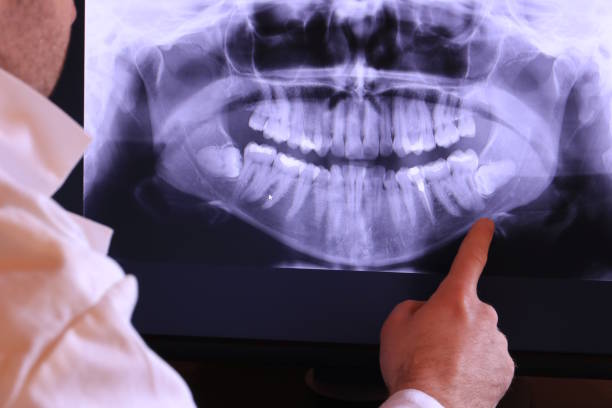 Best Emergency Treatment for Dental Infections or Abscesses in Meadowlakes, TX
